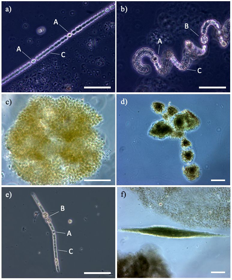 Generi di cianobatteri potenzialmente produttori di tossine nei laghi artificiali del Mediterraneo: (a, b) diverse specie di Dolichospermum del Lago Bidighinzu; (c, d) diverse specie di Microcystis del lago Liscia e del Lago Monte Lerno; (e, f): singolo tricoma e fascio di tricomi di Aphanizomenon dal Lago Liscia. A: eterocisti, B: acinete; C: cellule vegetative; barra 50 µm